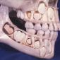 Child's Skull Before Losing Baby Teeth