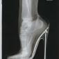 High Heels in an X-Ray