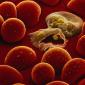 Red blood cells infected with malaria