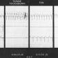 Neil Armstrong's Heartrate 